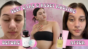 my reset routine || how i cleared my skin in 3 days!