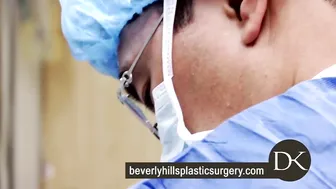 asian breast augmentation los angeles #6