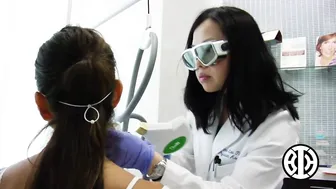 Photofacial laser to treat sunspots #7