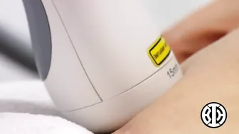 Laser Resurfacing to Treat Surgery Scars #7