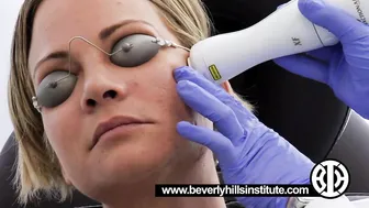 Nonablative fractional resurfacing laser treatments to acne scars #7