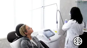 Nonablative fractional resurfacing laser treatments to acne scars #8