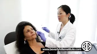 Sculptra to combat collagen deflation in the cheeks #8