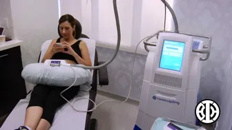 CoolSculpting to Lower Abdomen