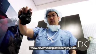 Breast Augmentation removal, replace and lift #3