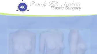 Breast Lift with Silicone Implant Augmentation Before and After #7