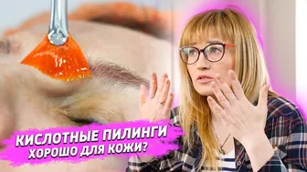 Кислотные Пилинги БЕЗ ВРЕДА для Кожи - Как правильно пользоваться #1