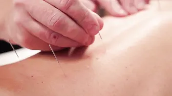 ACUPUNCTURE ASMR MASSAGE FOR ANNA'S LOWER BACK AND LEGS #6