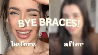 getting my braces removed (FINALLY) + a day in my life ???? | Zarias